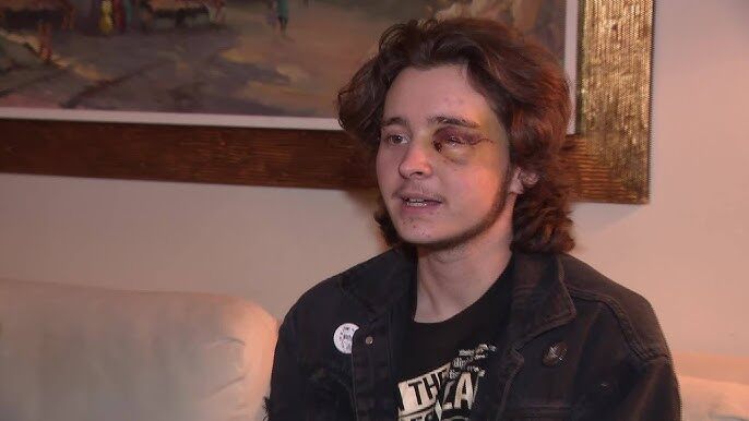 Protester blinded by federal agent in O.C. speaks out - YouTube